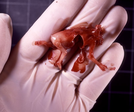 http://assets.petities.nl/system/uploads/818/original/11-week-aborted-fetus-t.jpg?1303025889